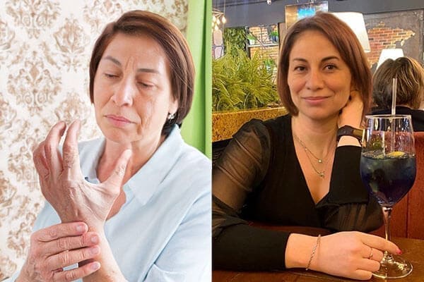 Alivio tras primera aplicación