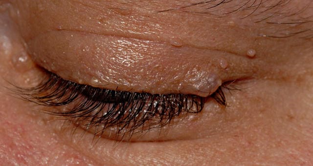 ภาพปรสิต